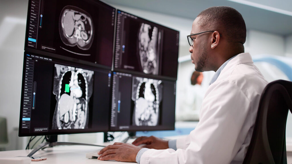 AI Beats Radiologists in Detecting Pancreatic Cancer on Routine CT Scans