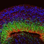 Lab-grown models of human brains are advancing rapidly. Can ethics keep pace?