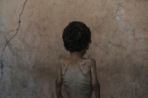 What Comes After Starvation in Gaza?