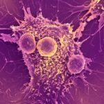 COVID-19 mRNA vaccines can trigger the immune system to recognize and kill cancer, research finds