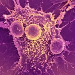 COVID-19 mRNA vaccines could unlock the next revolution in cancer treatment – new research