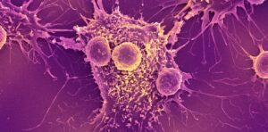 COVID-19 mRNA vaccines could unlock the next revolution in cancer treatment – new research