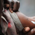 Africa: Measles Deaths Down 88% Since 2000, but Cases Surge