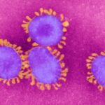 COVID During Pregnancy May Raise Autism Risk, Study Suggests