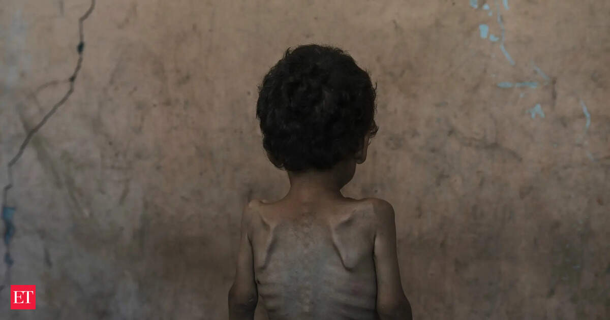 These numbers show how 2 years of war have devastated Palestinian lives in Gaza