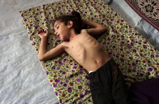 Tens of thousands of pre-school age children in Gaza are starving to death