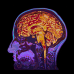 The Brain’s Hidden Drain