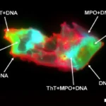 Strange microscopic structures found in Long COVID blood