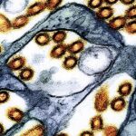 Washington state resident dies of new H5N5 form of bird flu