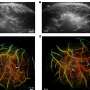 3D hybrid imaging system could address limitations of MRI, CT and ultrasound