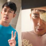 Elvin Ng undergoes emergency eye surgery after observing ‘dark circular shadow’ in vision, Entertainment News