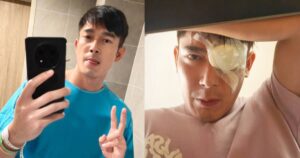 Elvin Ng undergoes emergency eye surgery after observing ‘dark circular shadow’ in vision, Entertainment News