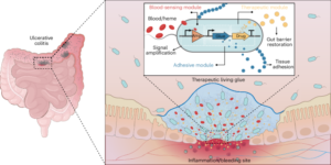 A therapeutic glue that autonomously targets gut bleeding in inflammatory bowel disease