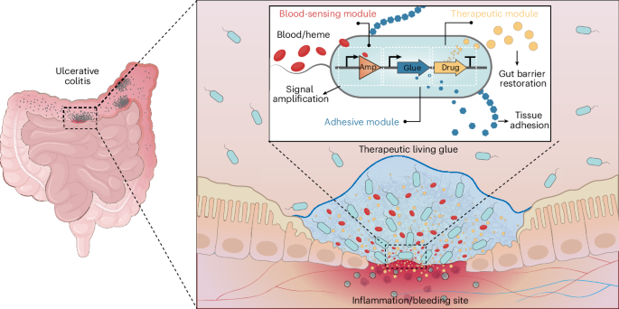 A therapeutic glue that autonomously targets gut bleeding in inflammatory bowel disease