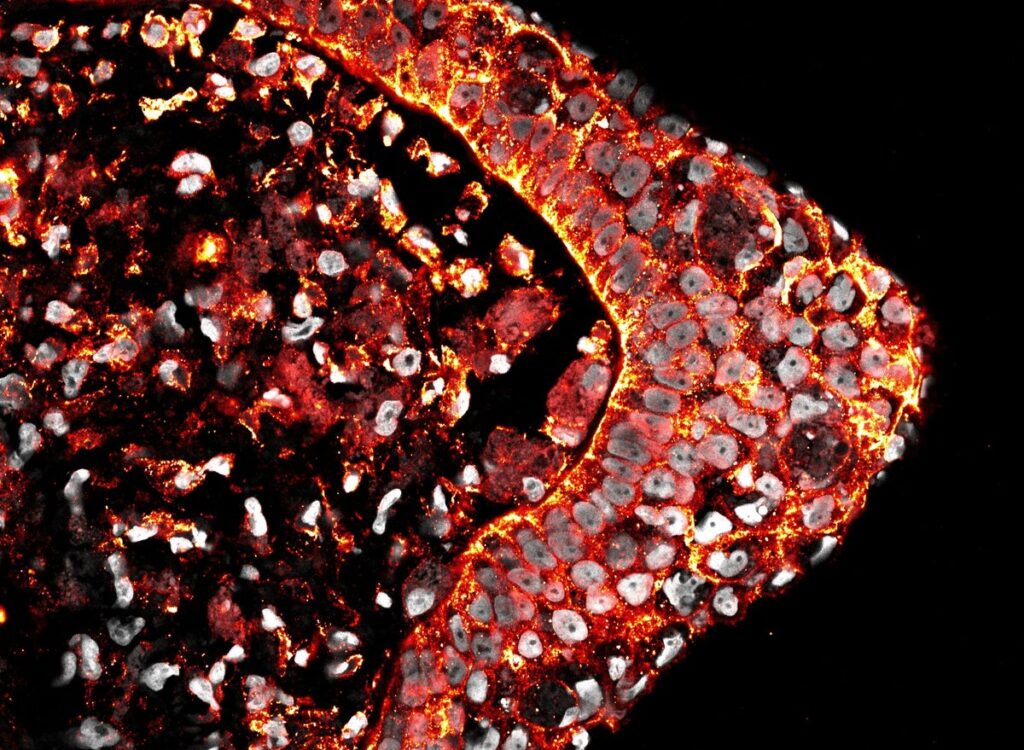 Why can’t humans regenerate limbs? New research offers a clue