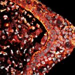 Why can’t humans regenerate limbs? New research offers a clue