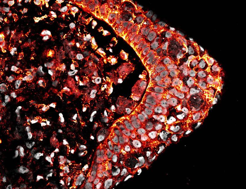 Species-specific oxygen sensing governs the initiation of vertebrate limb regeneration | Science