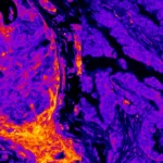 Hidden metabolism found operating inside the cell nucleus