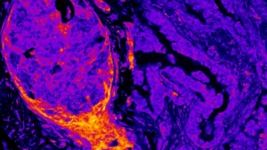 Hidden metabolism found operating inside the cell nucleus