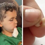 More Kids Are in ERs for Tooth Pain. Trump Cuts and RFK Jr.’s Anti-Fluoride Fight Aren’t Helping.