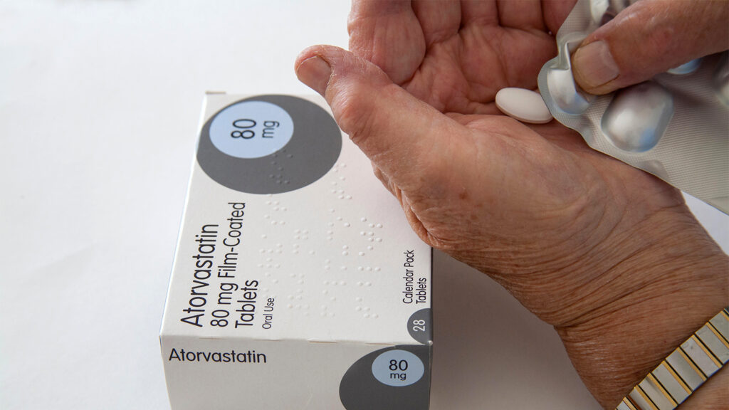 New Lipid Guidelines Redefine Risk Categories, Loop in People as Young as 30