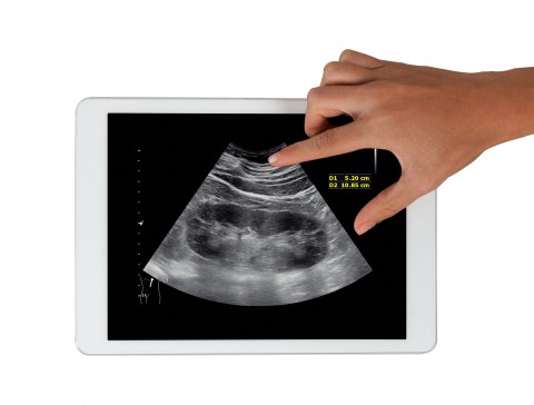 Understanding kidney health: What South Africans need to know