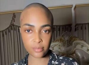 Blessing CEO sparks fresh health concerns with strange body changes