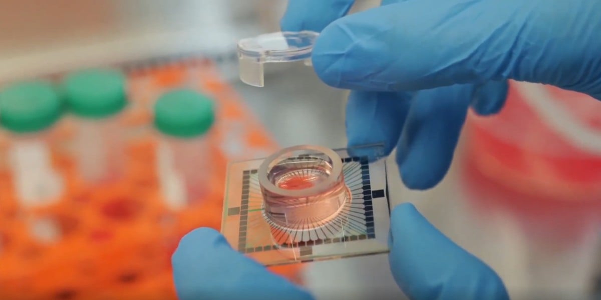 Inside the datacenter where the day starts with topping up cerebrospinal fluid