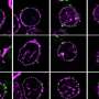How HIV hijacks a cellular ‘gateway’ to infect resting immune cells