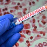 There’s little chance of a hantavirus global outbreak. What the latest odds say