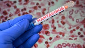 There’s little chance of a hantavirus global outbreak. What the latest odds say