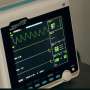 Less invasive method to assess coronary flow similar to gold standard, study shows