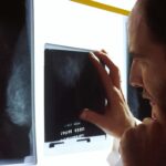 Blood Signature IDs Lung Cancer Risk, Prevention Targets | Mirage News