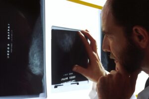 Blood Signature IDs Lung Cancer Risk, Prevention Targets | Mirage News