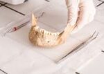 Ancient Teeth Suggest Europeans Rarely Ate Bugs — and May Have Been Less Adapted to Digest Them