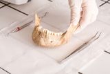 Ancient Teeth Suggest Europeans Rarely Ate Bugs — and May Have Been Less Adapted to Digest Them