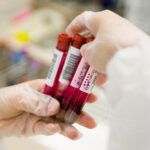 Recommending Blood Tests for CRC Without Guardrails Risks Confusion