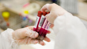 Recommending Blood Tests for CRC Without Guardrails Risks Confusion